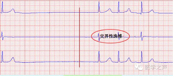中国口吃矫正界泰斗钱厚心讲述口吃矫正法_孕妇心电图一般多少钱_图音导航一体机接钱图