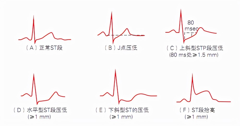 做第二次流产有没有什么影响_肝功能不空腹影响大吗_空腹做心电图有影响吗