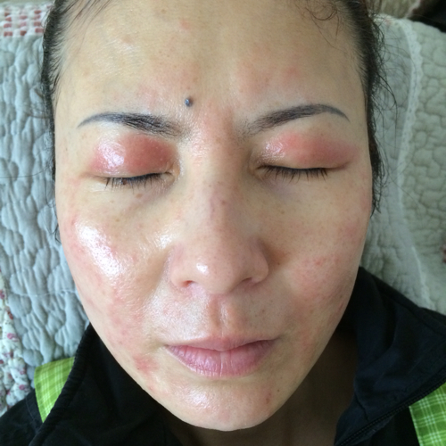 私密整形属于身体美容吗_美容院做身体价格表_潍坊美容冠名院华贝