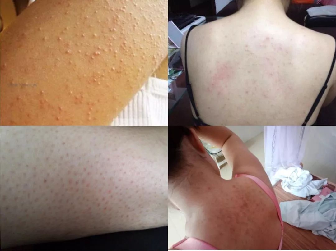 精油开背后洗澡怎么办_马小茜谎言背后洗澡_温柔的背后 杨桃洗澡