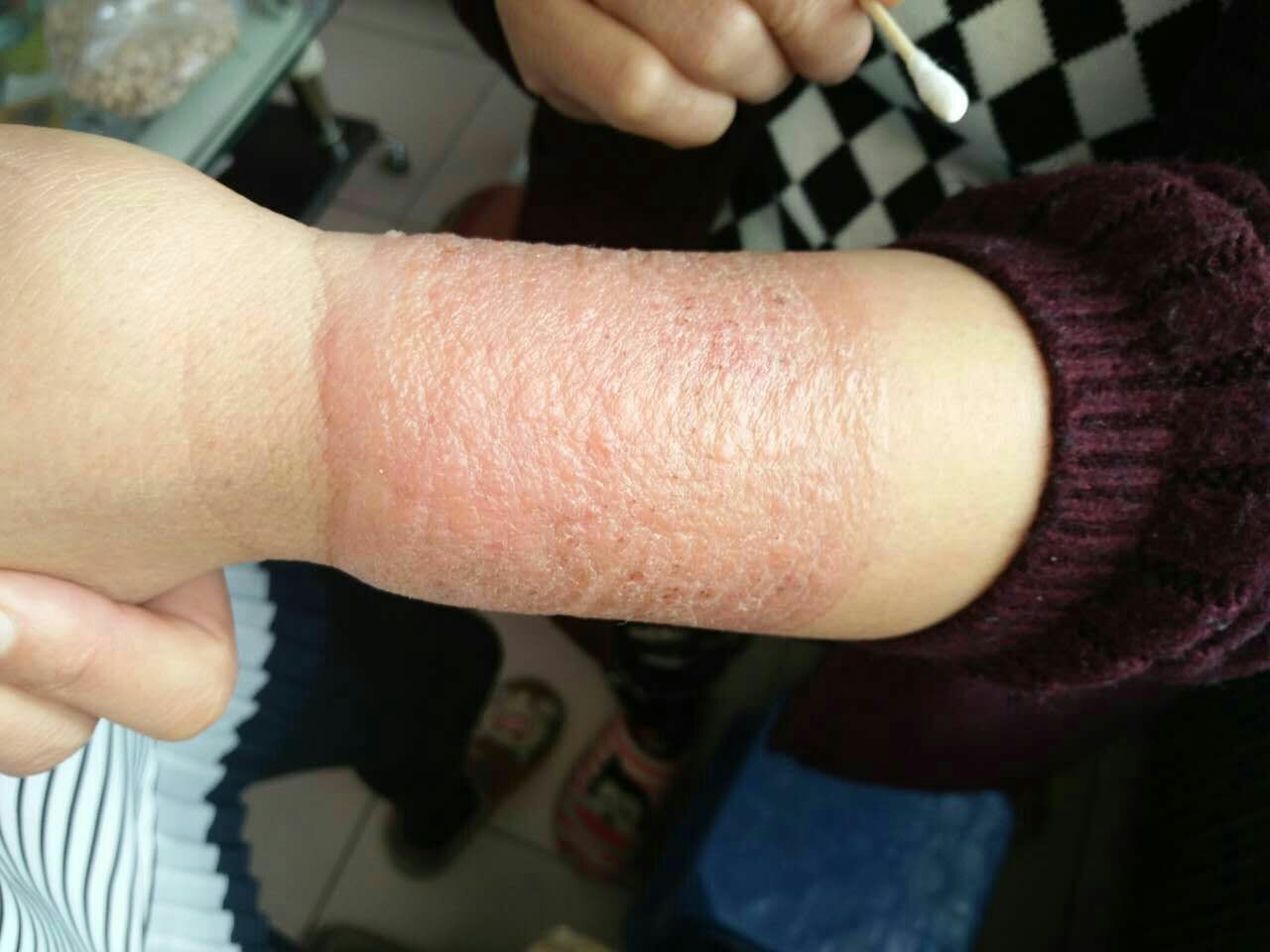 膏药贴上发凉是否有效_膏药一般要连续贴几贴_膝盖凉贴什么膏药
