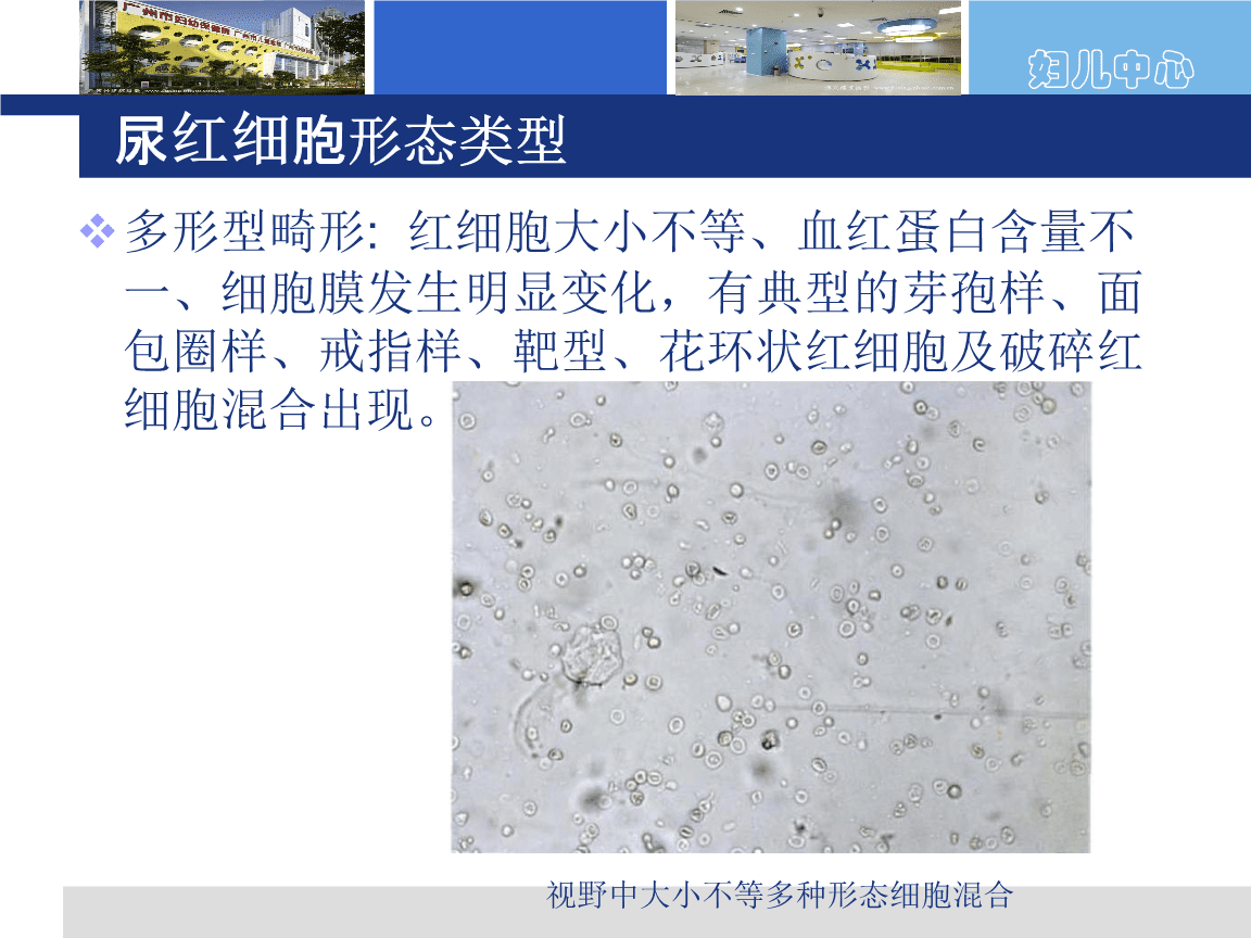 面包圈红细胞是什么_轮胎气压表看红圈还是黑圈_尼康金圈和佳能红圈