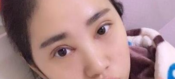 做双眼皮能保持多少年_做黄金微雕能保持多久_做线雕能保持多长时间