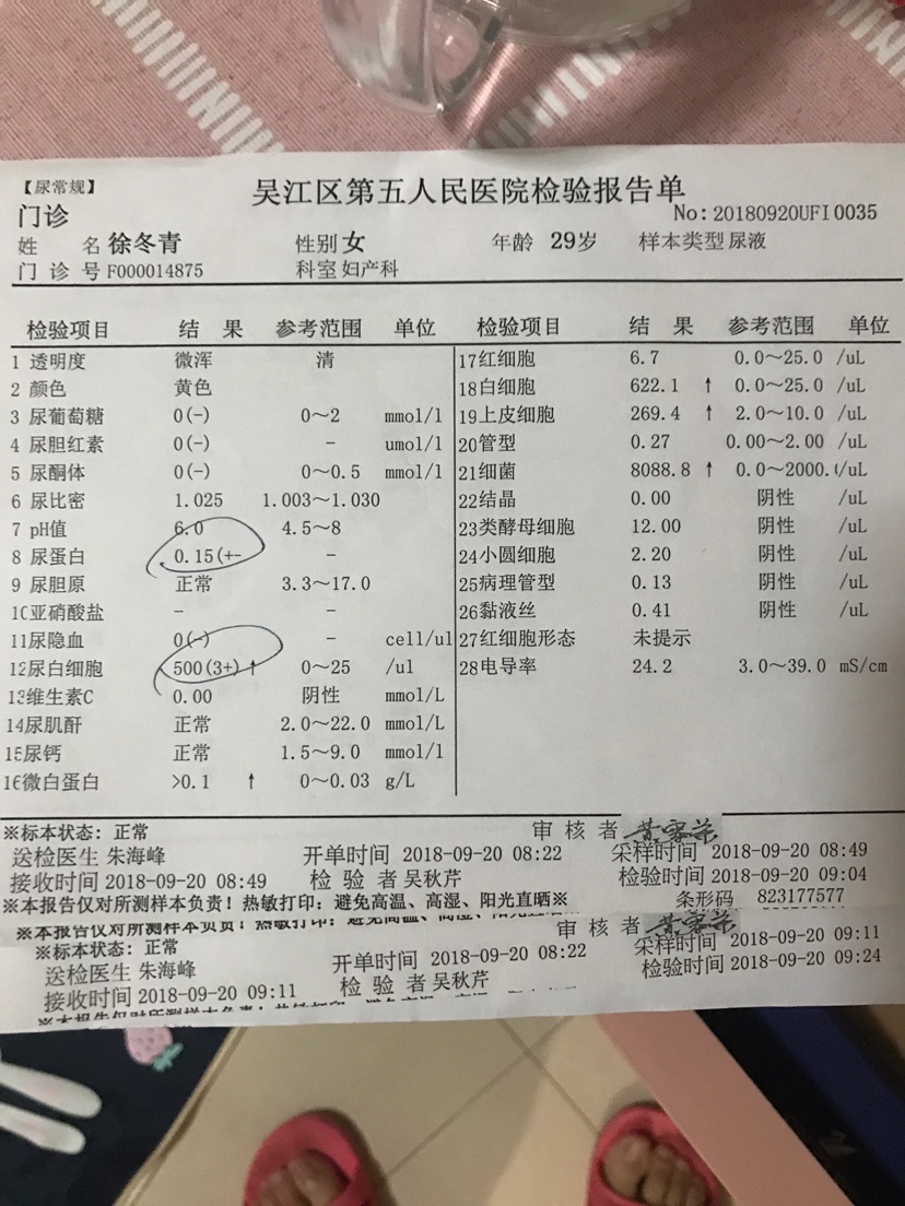 系统性红斑狼疮肾炎 京东誉美_尿里蛋白高严重吗_尿蛋白高是怎么回事.京东誉美