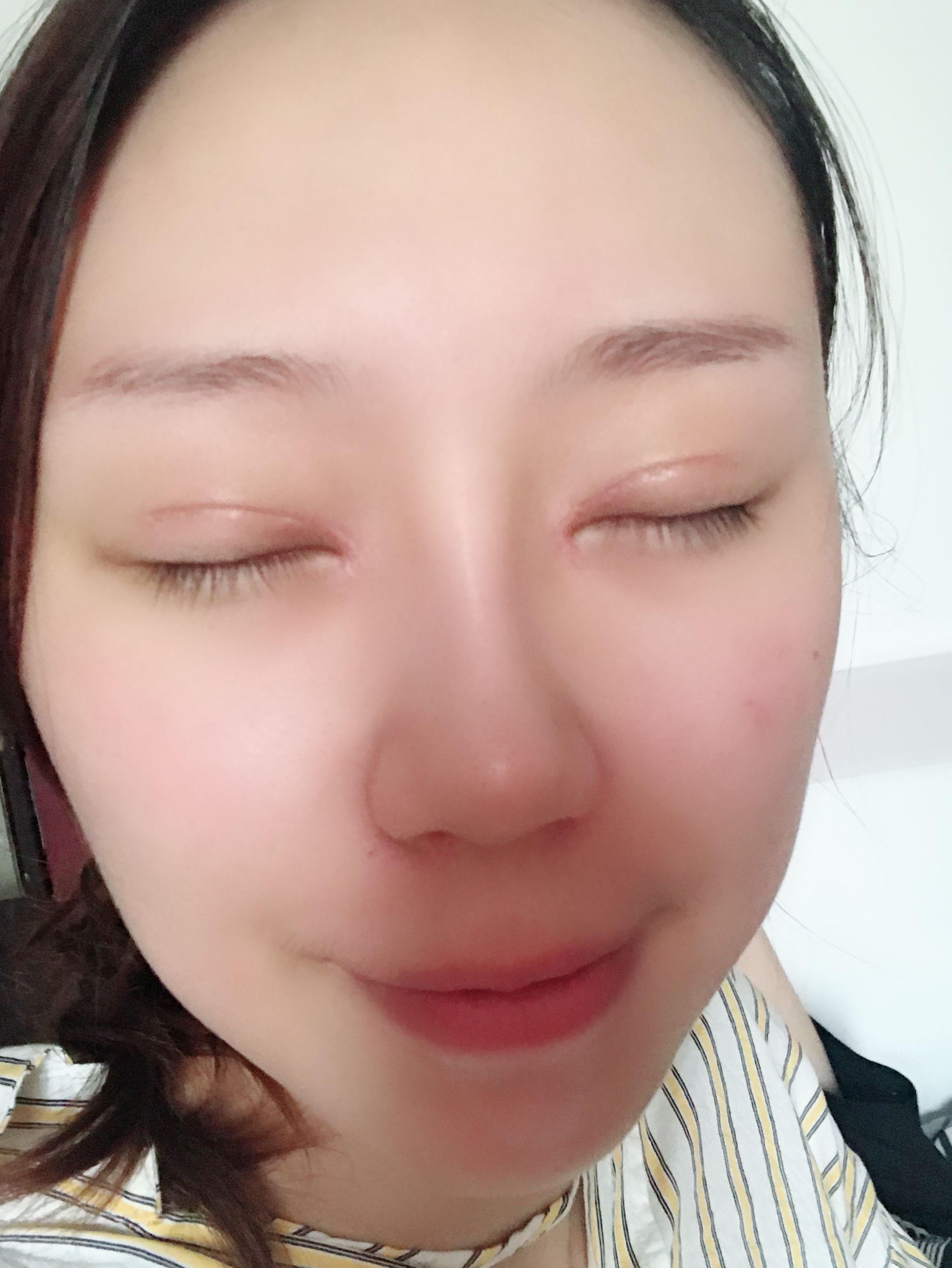 粳米粉可以做冰皮吗_做完皮秒多久可以做纳米微针_天津哪里可以做双眼皮