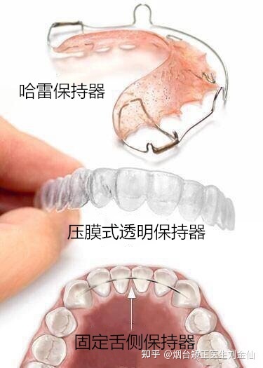 减肥可以吃煎的东西吗_戴保持器可以吃东西吗_怀孕可以吃火锅料煮的东西吗