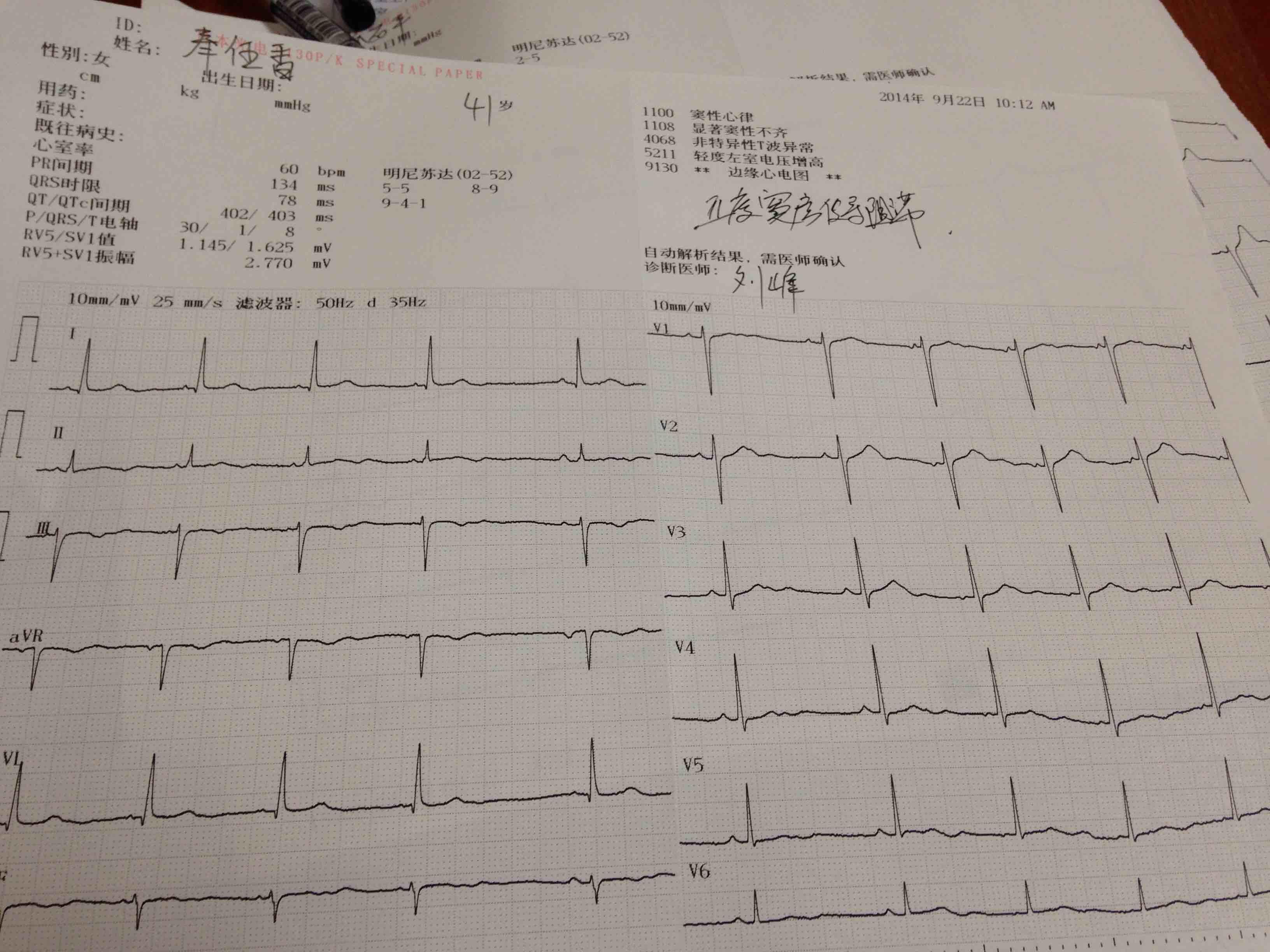 电压低对电脑的影响_空腹做心电图有影响吗_做唐氏筛查需要空腹吗