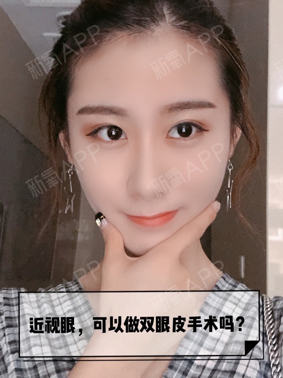 做双眼皮开眼角隆鼻销骨恢复照片_做双眼皮的坏处_做双眼皮价格介绍