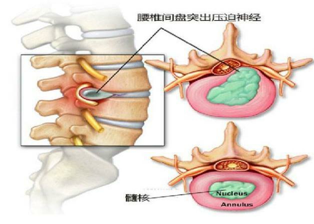 外擦药酒配方_外用镇疼药酒价格_疼风养生药酒秘方