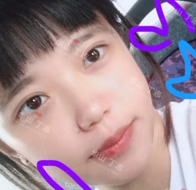 广东哪里做皮秒祛斑好?_内双做哪种双眼皮好_做云吞皮用什么面粉好