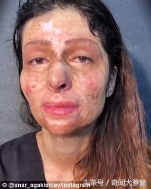 油贱到手上烫伤怎么办_手贱手贱手贱扔了不该扔的东西_手被油烫伤起泡后怎么处理办法