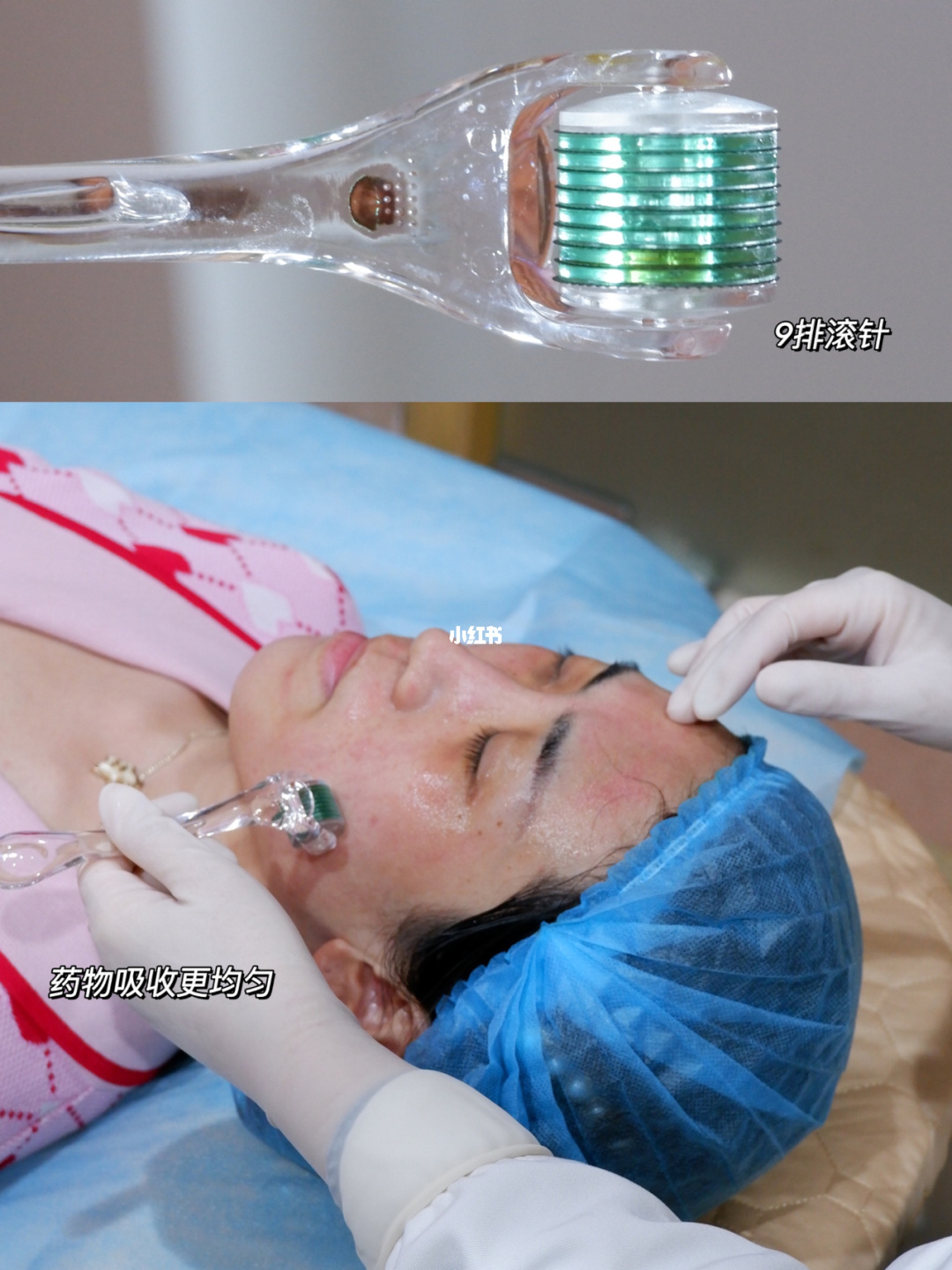 膝关节打润滑针有什么副作用吗_美容店打水光针有副作用吗论坛_去斑打美容针好还是激光好