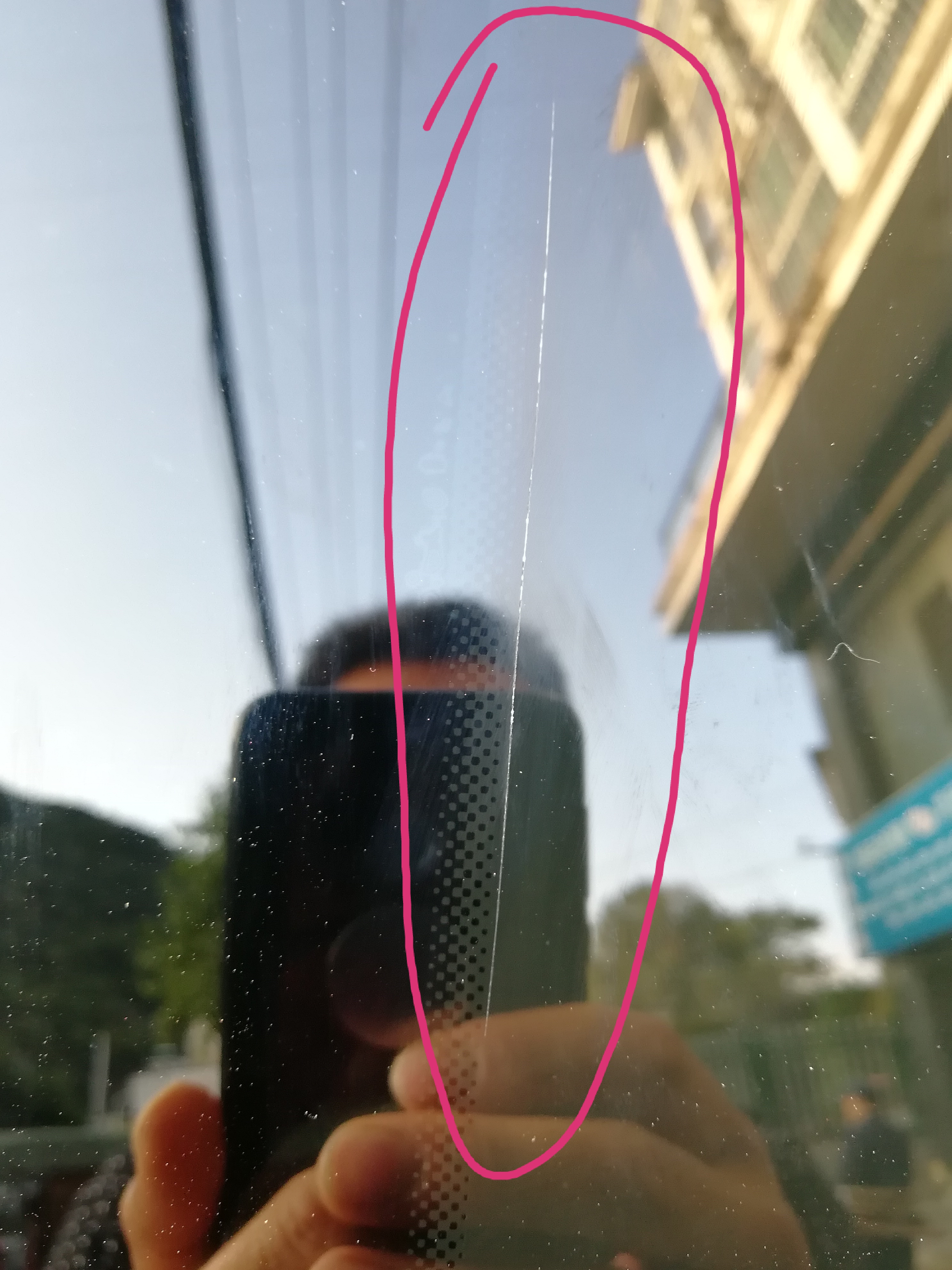 处膜修复需要多少钱_修复处膜要什么科_有人做过修复处膜