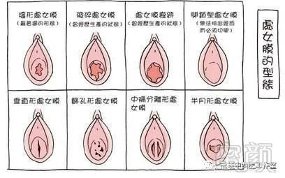 处膜修复需要多少钱_有人做过修复处膜_补处膜修复危害