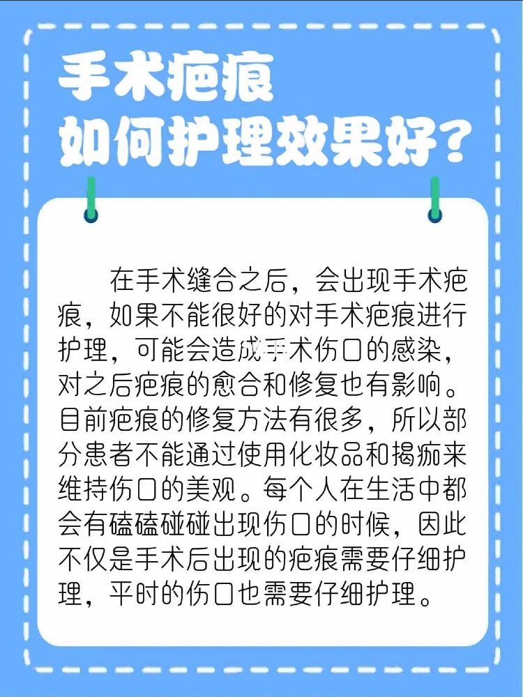 纽拉打下巴能维持多久_欣皮护切口保护器 厂家_小切口拉皮能维持几年