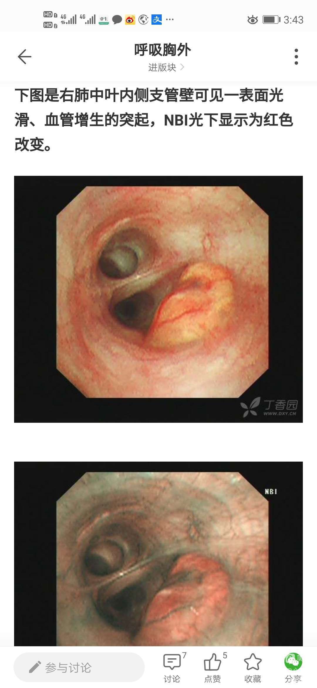 支架后能喝银骏眉_金骏眉银骏眉铜骏眉_金骏眉和银骏眉图片