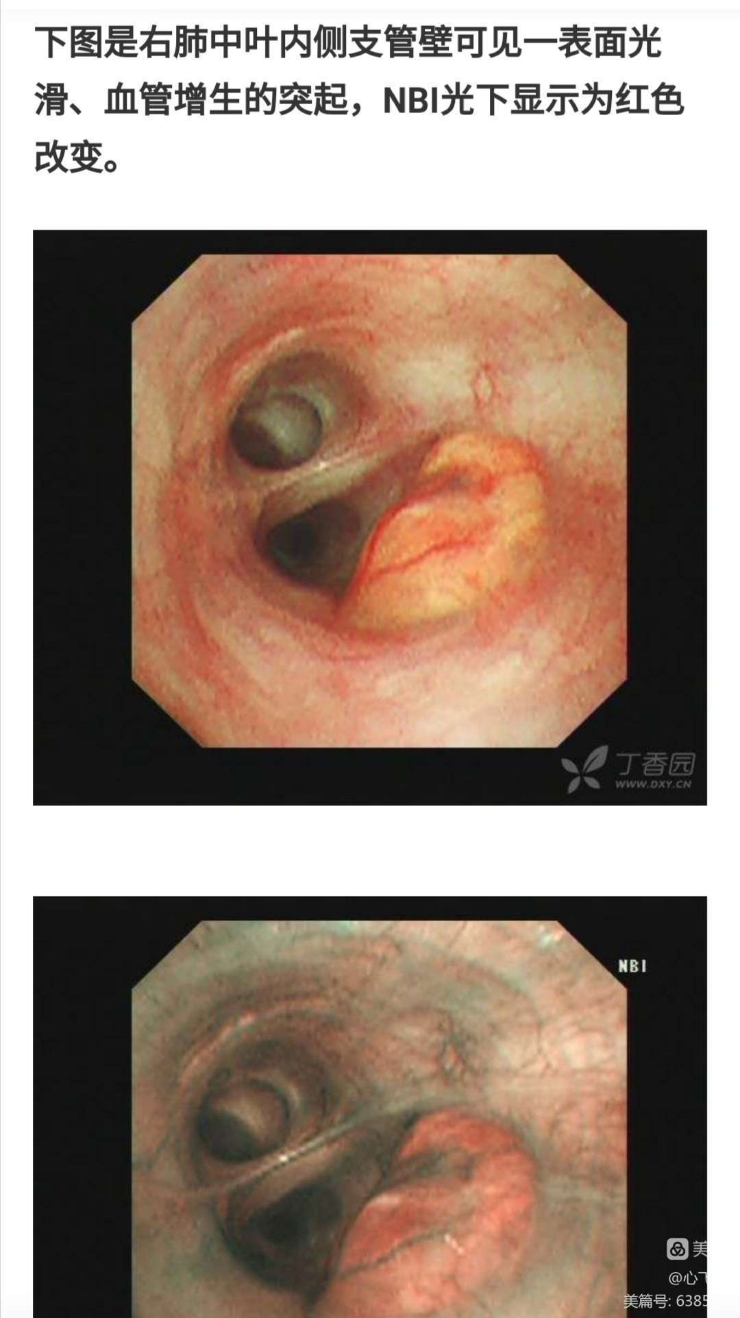 金骏眉银骏眉铜骏眉_金骏眉和银骏眉图片_支架后能喝银骏眉