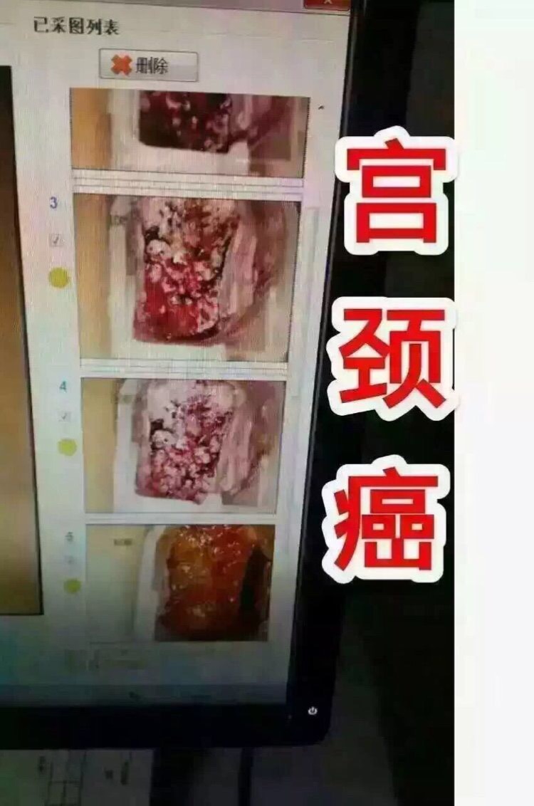 百脉纳米银妇女外用抗菌凝胶_哪家网上药店有售爱杰特纳米银妇女外用抗菌凝胶_伊莎丽尔妇女外用抗菌凝胶
