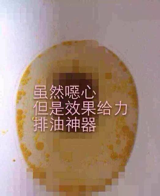 澳洲排油丸伤身体吗_澳洲排油丸注意事项_澳洲排油丸xenical有效果吗