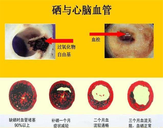 补硒的产品最好的是哪一种_的补硒产品_补硒产品图片琳琅满目