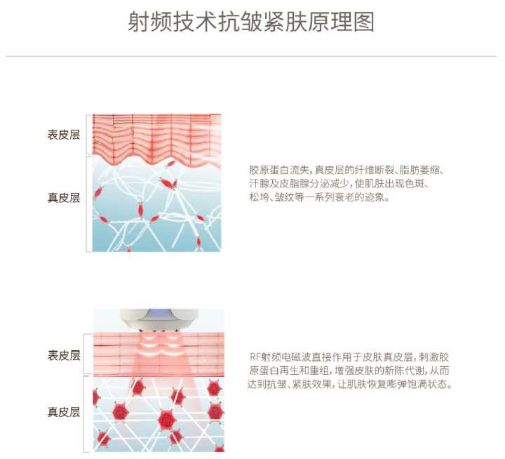 皮肤从褪皮到长新皮需要多久_电波拉皮需要做几次_电波拉皮需要多少钱
