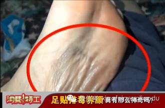 什么茶去湿气排毒_去寒去湿气喝什么茶_足贴去湿气是真的吗