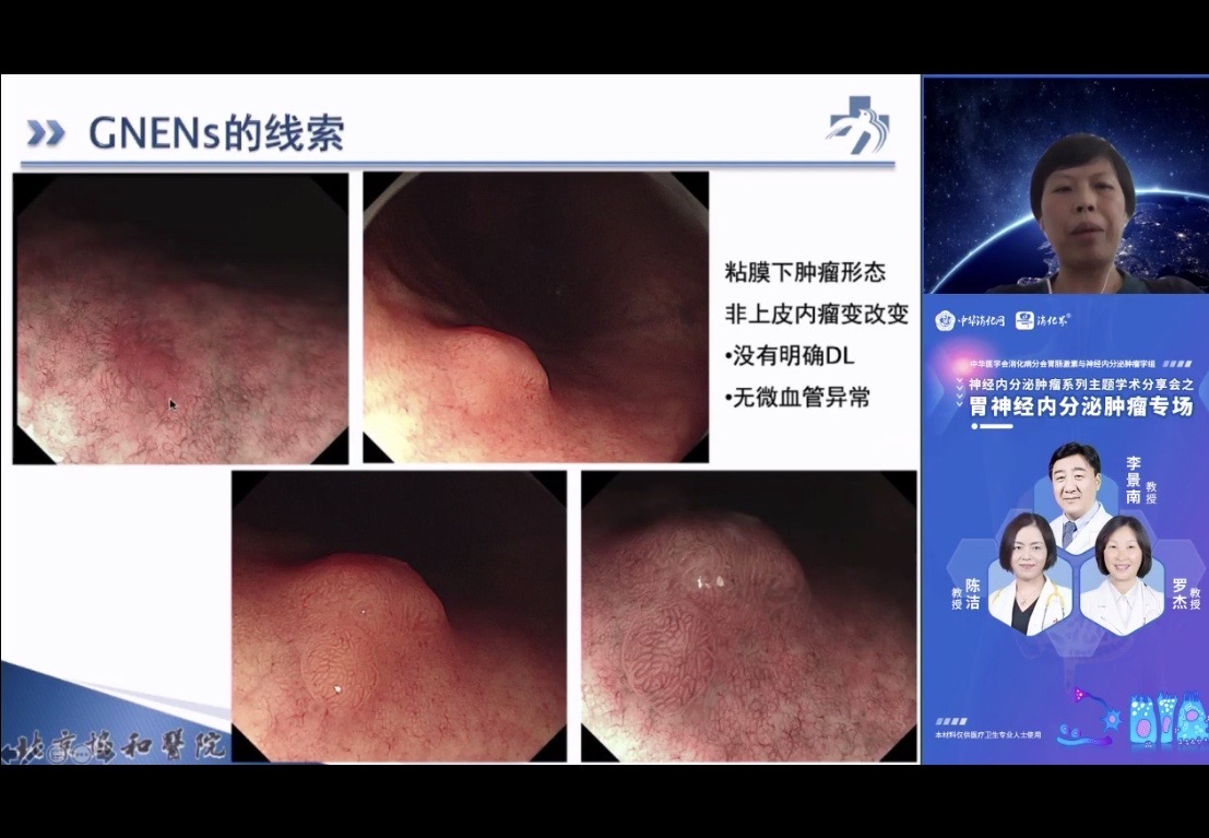 肠胃速康方_肠胃速康方哪里有买多少钱_枫蓼肠胃康海口奇力