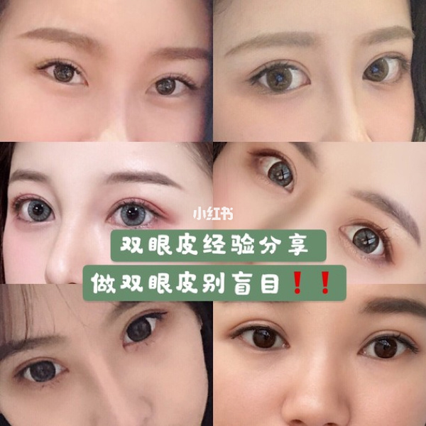 怎么看獭兔毛皮草是整皮还是拼皮_整双眼皮一般需要价钱_厦门双眼皮的价钱