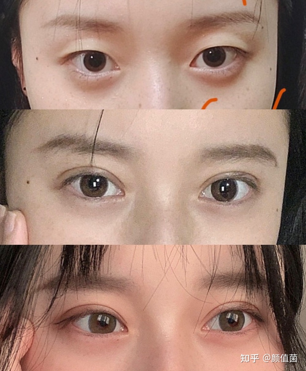 厦门双眼皮的价钱_怎么看獭兔毛皮草是整皮还是拼皮_整双眼皮一般需要价钱