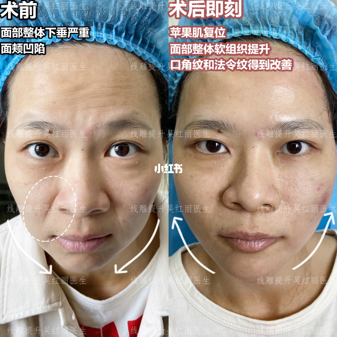 液体加肥站_康加健康站怎么开_想开个液体加肥站