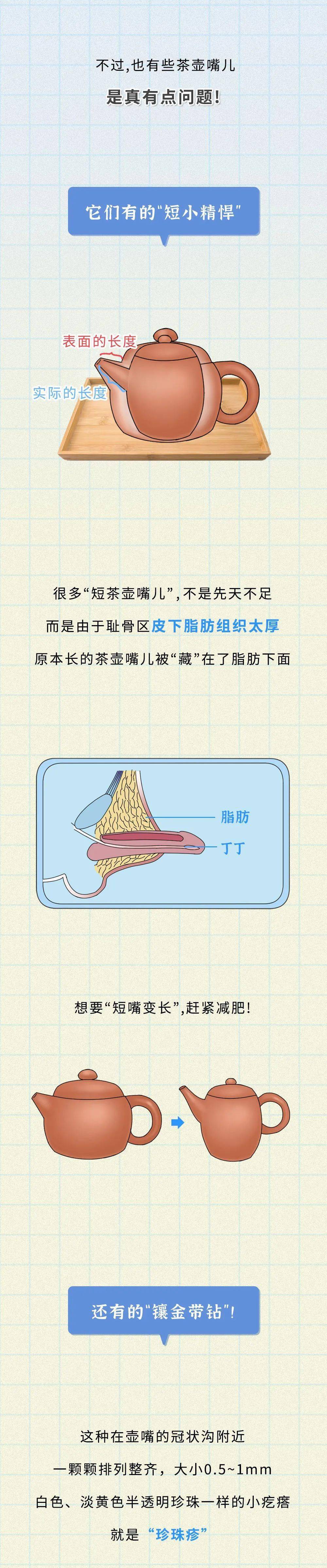增大变粗调情进口生活用品_增大粗乳膏的成份_弹簧变粗的k是增大还是减小