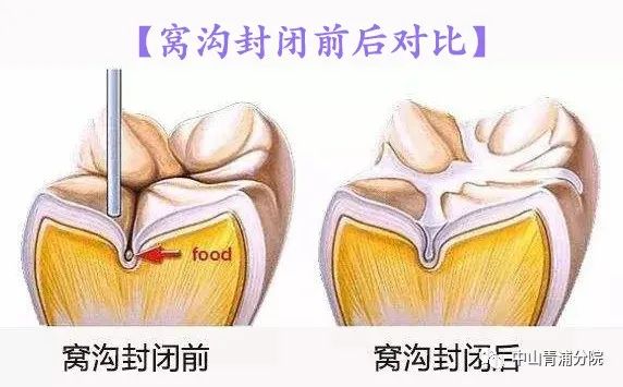 牙齿上有一层东西好臭_17层买7层好还是9层好_吃什么东西对牙齿好
