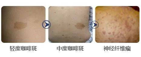 点斑水点斑后注意事项_上环后应注意哪些事项_点斑水点斑后注意事项