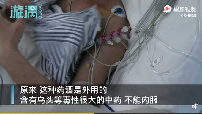 外用镇疼药酒价格_外擦药酒配方_外用镇疼药酒价格