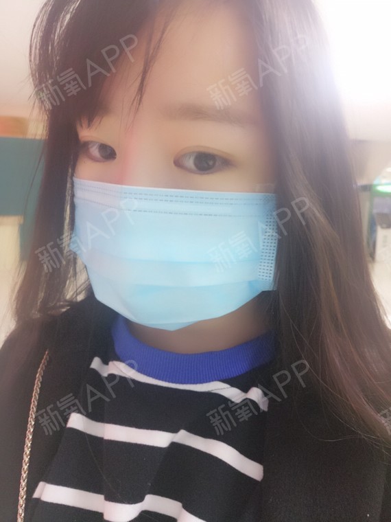 拉皮多久可以恢复好_灼烧点痣多久可以恢复好_超纤皮好还是pu皮好