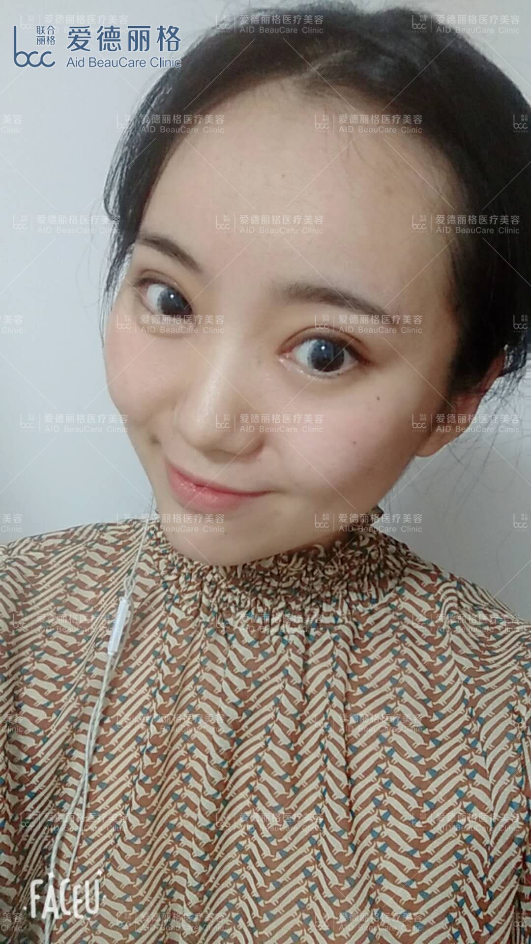 大连沙医生整形医院价格表_大连沙医生双眼皮价格_大连沙医生怎么样