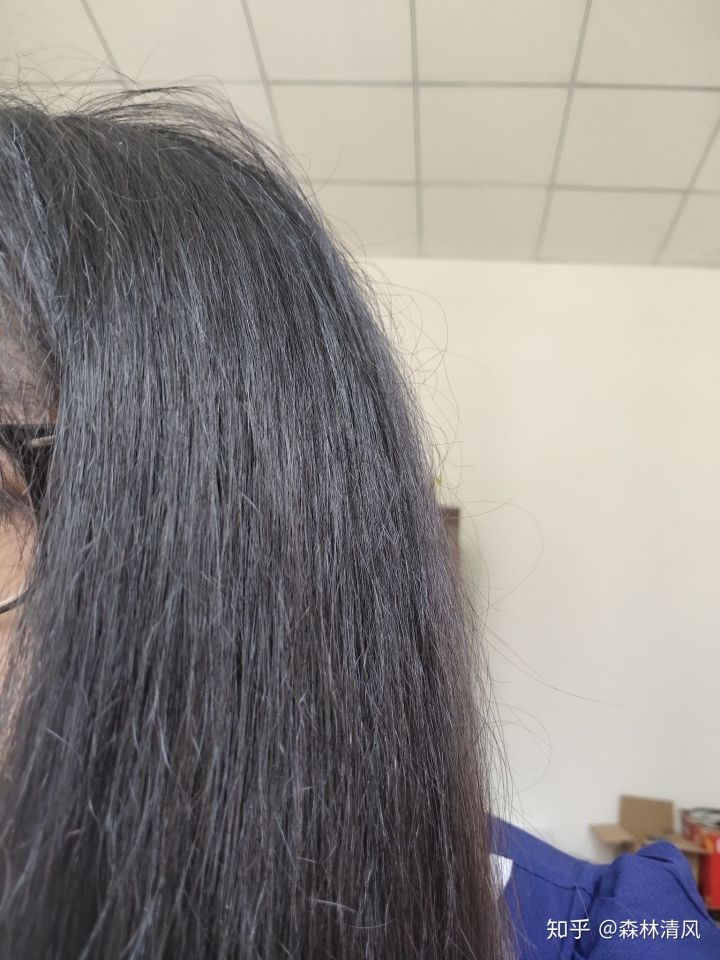 改善脸部凹陷的小妙招_绒面沙发清洗小妙招_改善沙发发质的小妙招