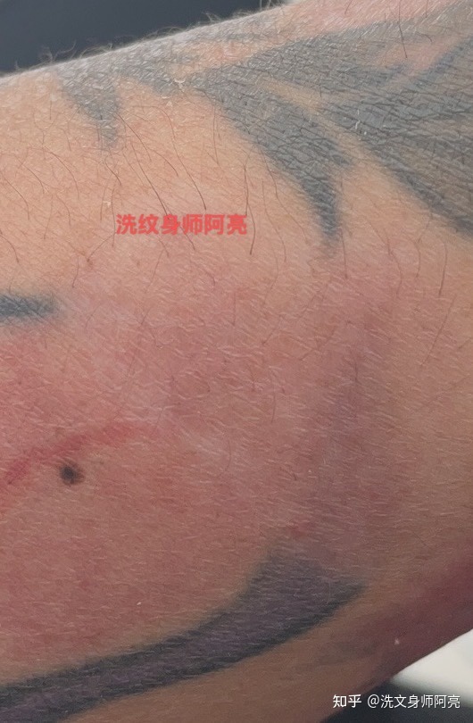 厦门纹身店有多少家_纹身店一般几点关门_人体绘画一般纹身店有吗