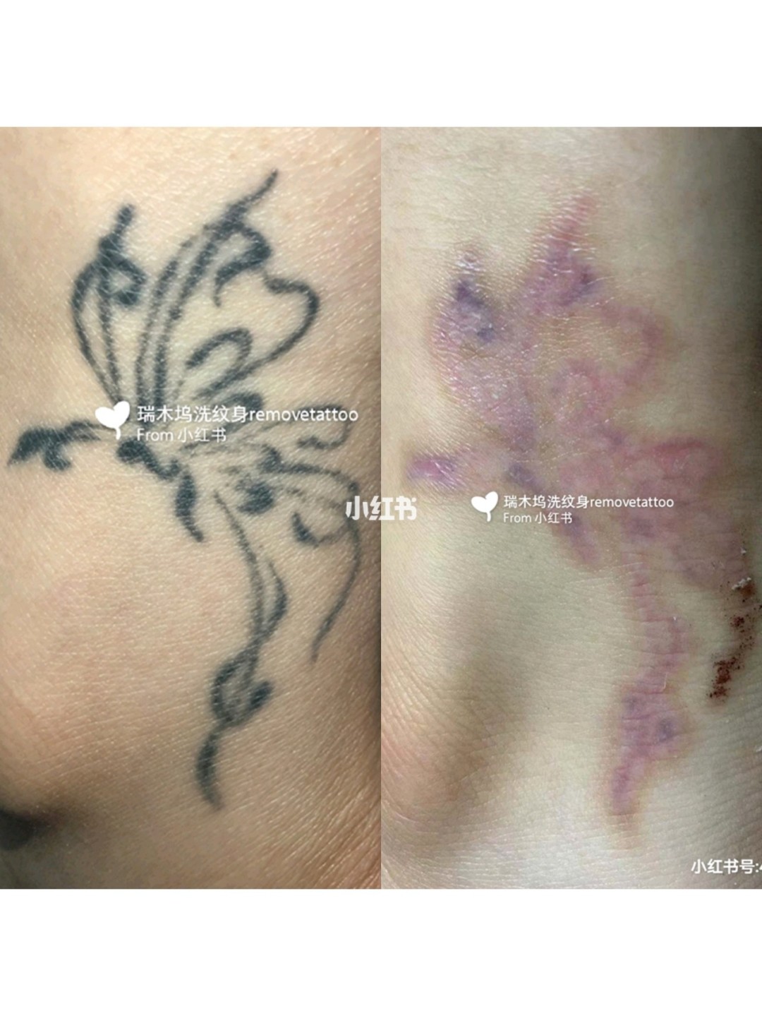 厦门纹身店有多少家_人体绘画一般纹身店有吗_纹身店一般几点关门