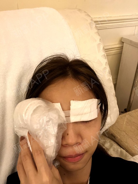 成都做双眼皮价格只來素美医术高_成都治疗失眠医院vr医术高脑康_祛抬头纹询6厦门美莱医术高