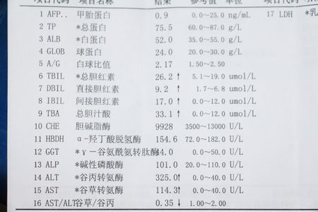 c反应蛋白偏高_发烧 超敏c反应蛋白偏高_前白蛋白偏高怎么办
