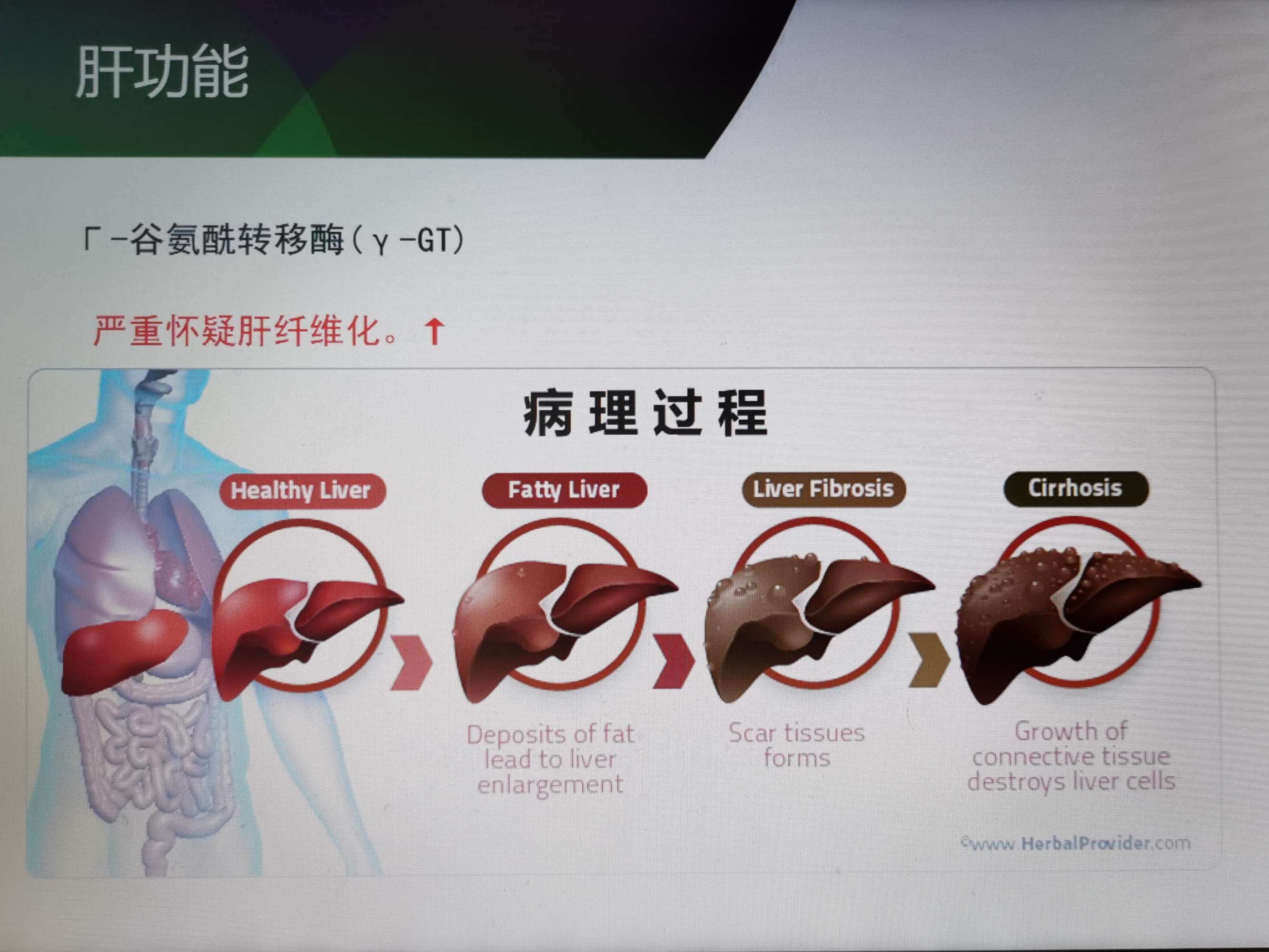 前白蛋白偏高怎么办_发烧 超敏c反应蛋白偏高_c反应蛋白偏高