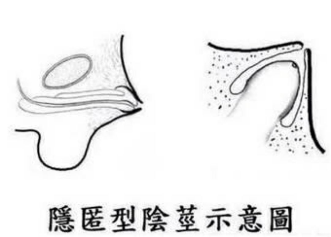 西洋参与须花参的区别_男人补肾吃参桂鹿茸丸_男人吃西洋参对性功能好吗