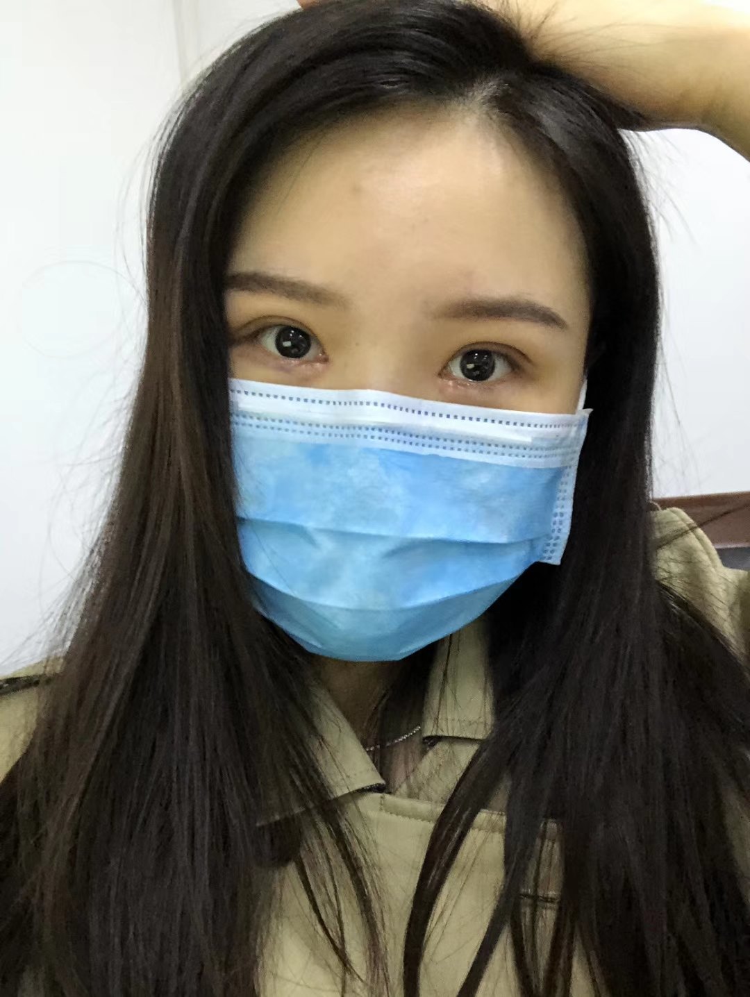 沈阳哪里做双眼皮手术好_沈阳哪家做双眼皮好_超纤皮好还是pu皮好