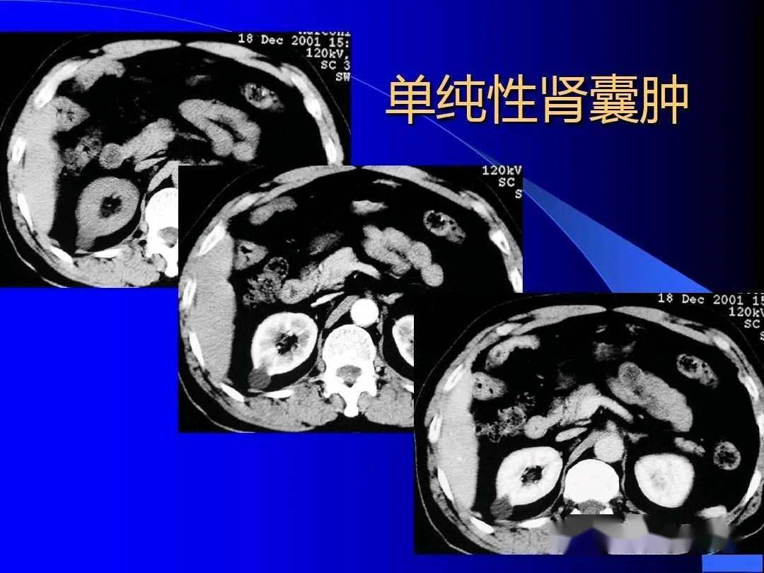 脖子后痒有疙瘩有水泡_童介眉小忽雷（上）^^^小忽雷（下）^^^陈三两（上）^^^_肾上有小水泡怎么办