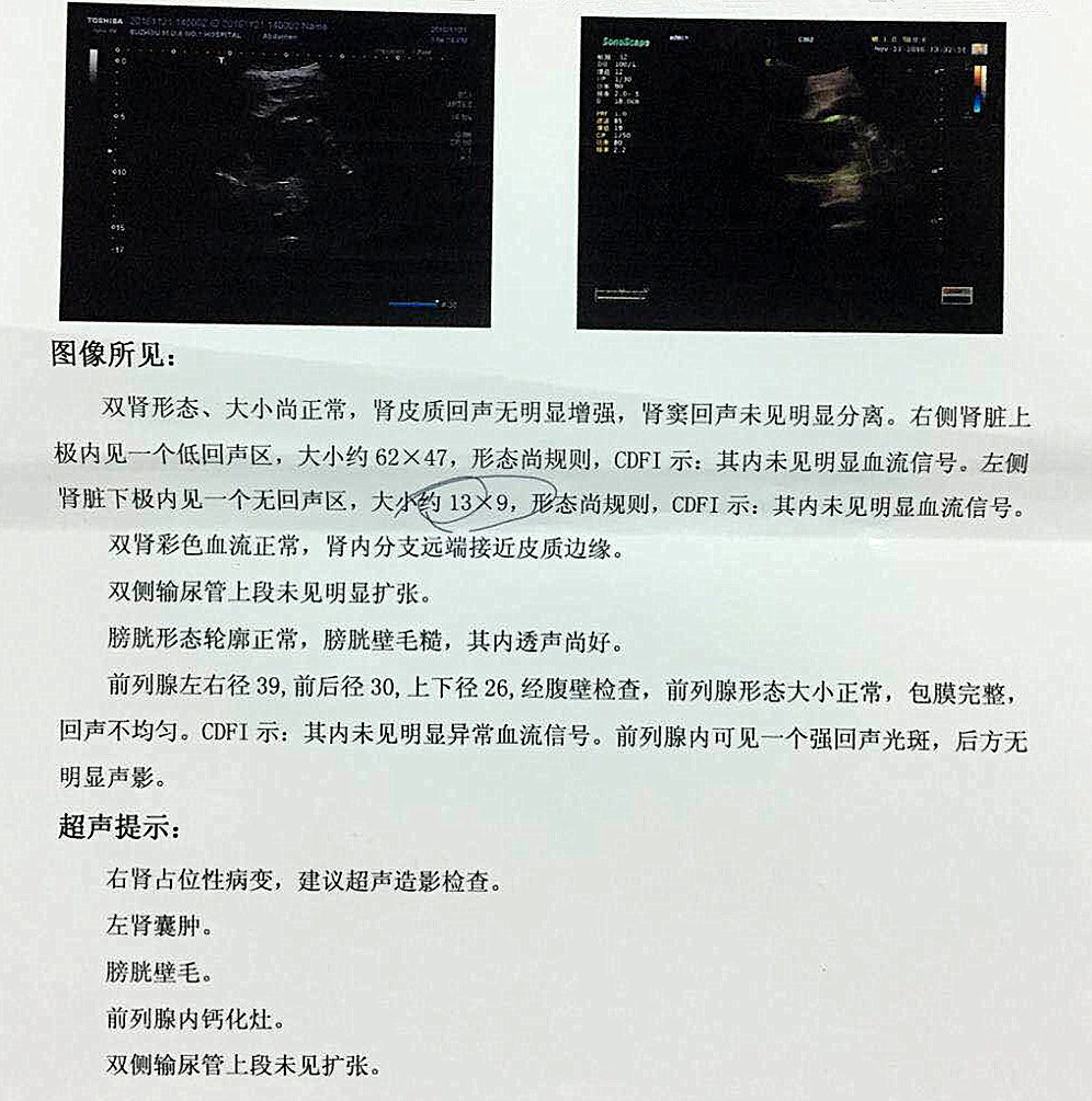 肾上有小水泡怎么办_脖子后痒有疙瘩有水泡_童介眉小忽雷（上）^^^小忽雷（下）^^^陈三两（上）^^^