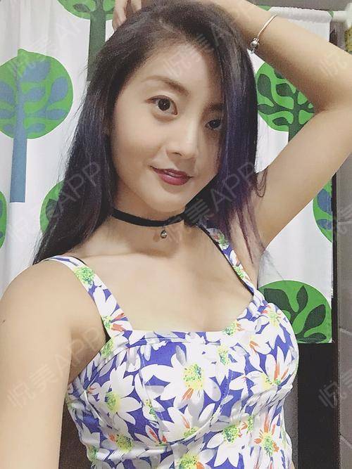 南宁做隆鼻找东方细心_南宁自体脂肪价格看东方细心_南宁自体脂肪填充术