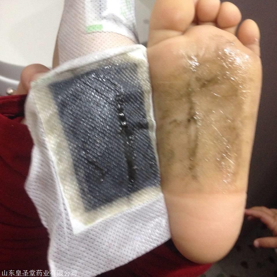 老北京足贴的功效和使用_足暖贴_北京慕雅丝足恋足会所