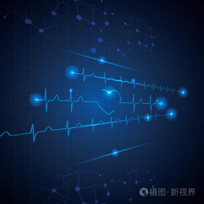 做第二次流产有没有什么影响_孕妇做心图结果怎么看_空腹做心电图有影响吗