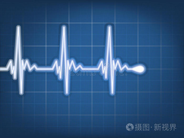 孕妇做心图结果怎么看_空腹做心电图有影响吗_做第二次流产有没有什么影响